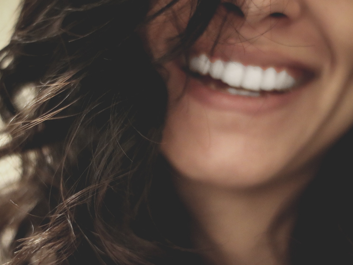 tratamiento de carillas dentales