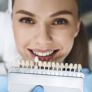 Carillas Dentales