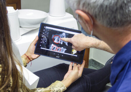 ¿Duele la extracción de las muelas del juicio?