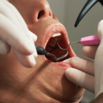 Duele un empaste dental.