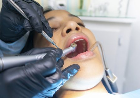 Absceso periapical: qué es y síntomas